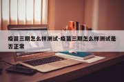 疫苗三期怎么样测试-疫苗三期怎么样测试是否正常